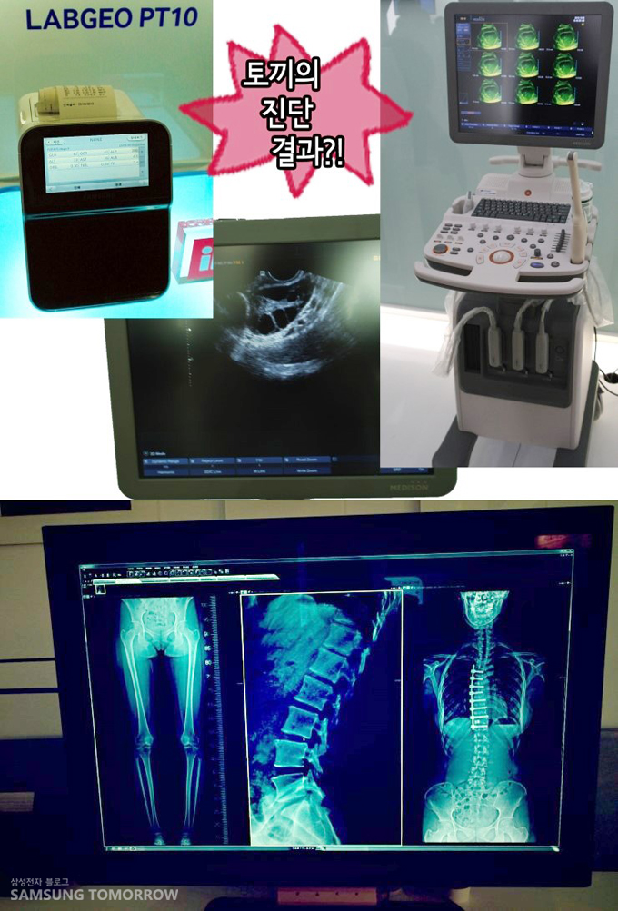 토끼의 진단 결과