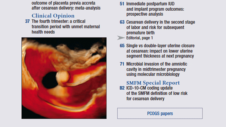 초음파 진단 영상