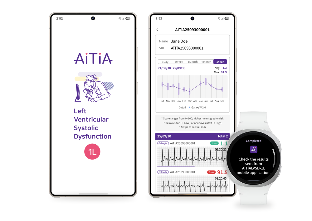 스마트워치 활용한 좌심실수축기능부전(LVSD) 탐지 기능 개발